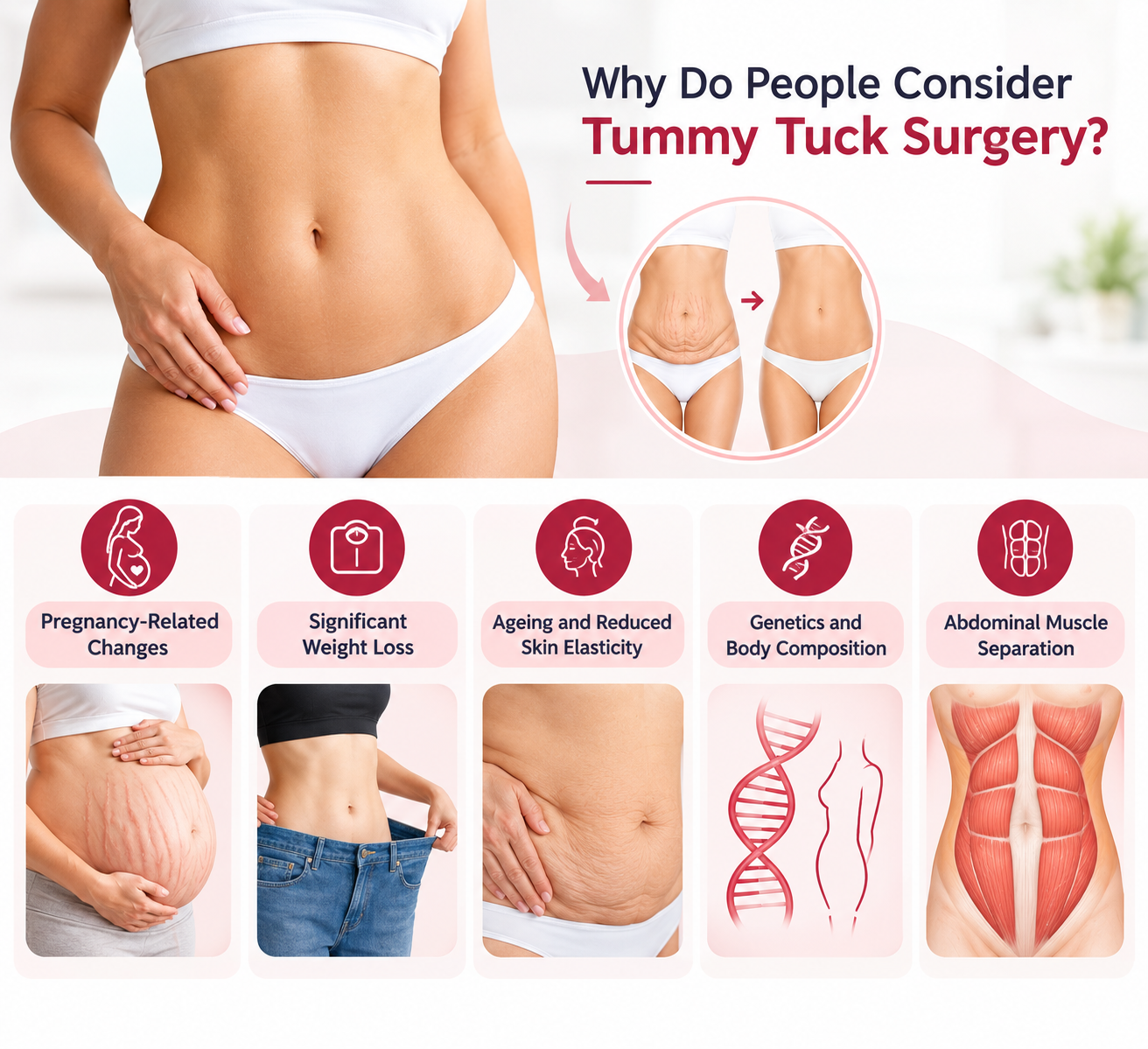Why people consider tummy tuck surgery